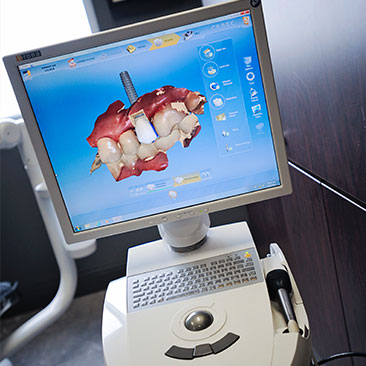 sirona galileos cbct